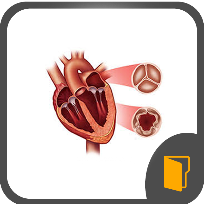Aortic Valve