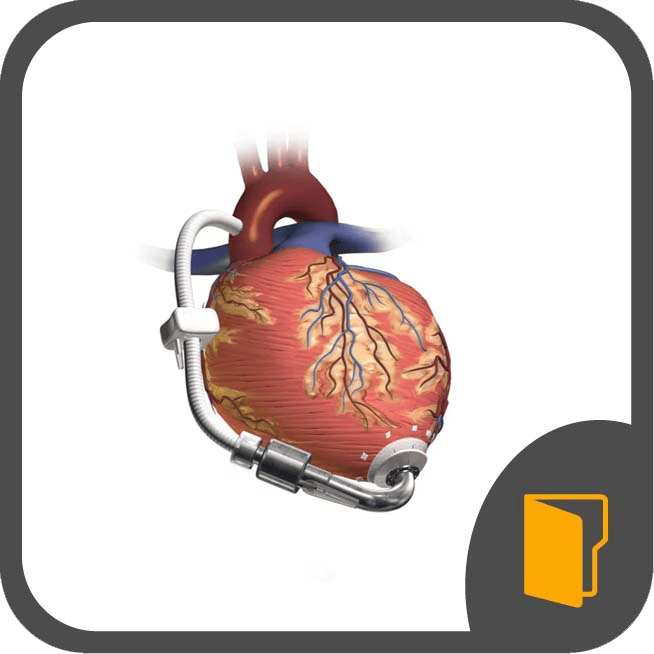 Mechanical Circulatory Support Devices