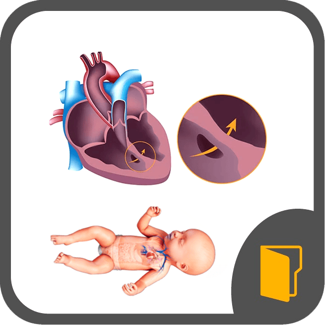 Congenital Heart Disease